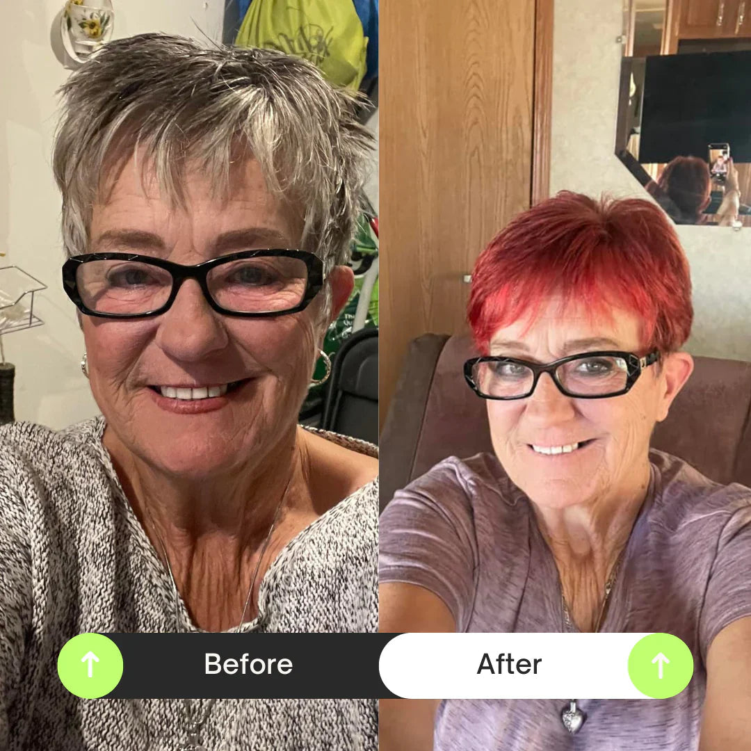 Beige_Minimalist_Skincare_Before_and_After_Instagram_Post.webp